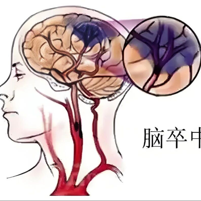 记住这4点，关键时刻能救命！